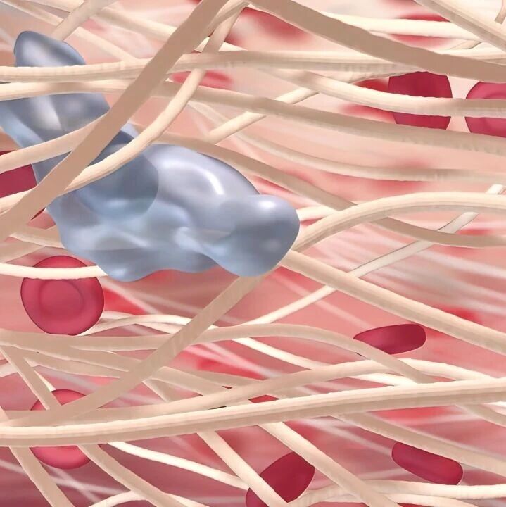 JCO丨维奈克拉在t(11;14)多发性骨髓瘤中的发展历程'